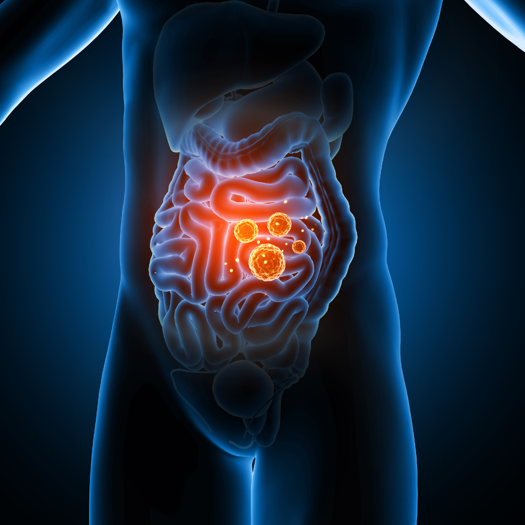 A Swedish Dietary Guideline Index, Gut Microbial α-Diversity, and Prevalence of Metabolic Syndrome